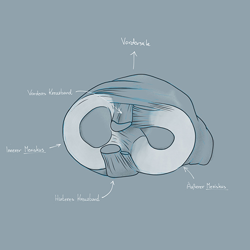 Medical Illustration of a meniscus, as seen from above